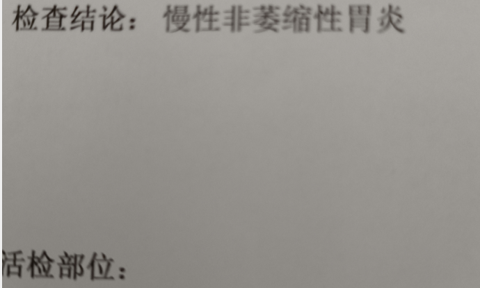 胃镜